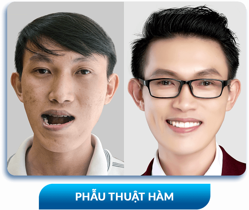 khách hàng phẫu thuật thẩm mỹ