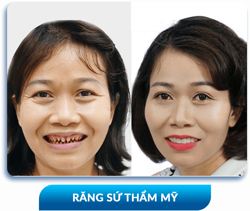 khách hàng phẫu thuật thẩm mỹ