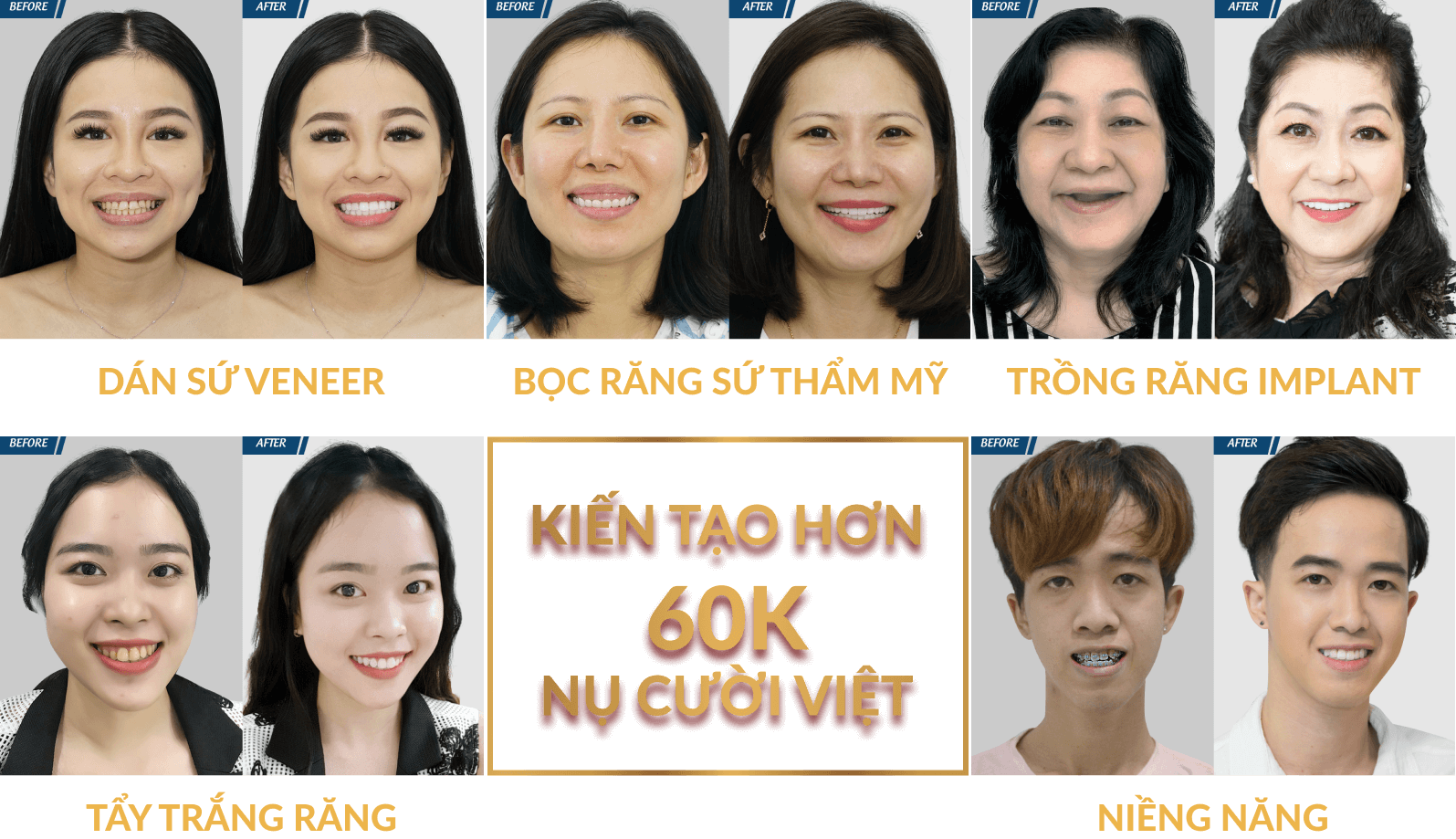 Răng Trắng Cười Sang