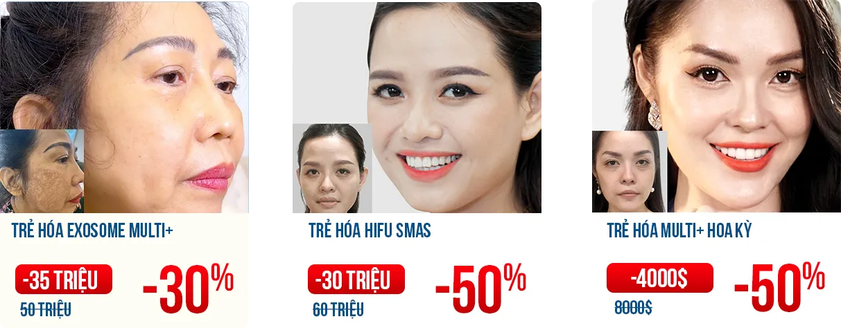 Cải Lão Gương Mặt 3M