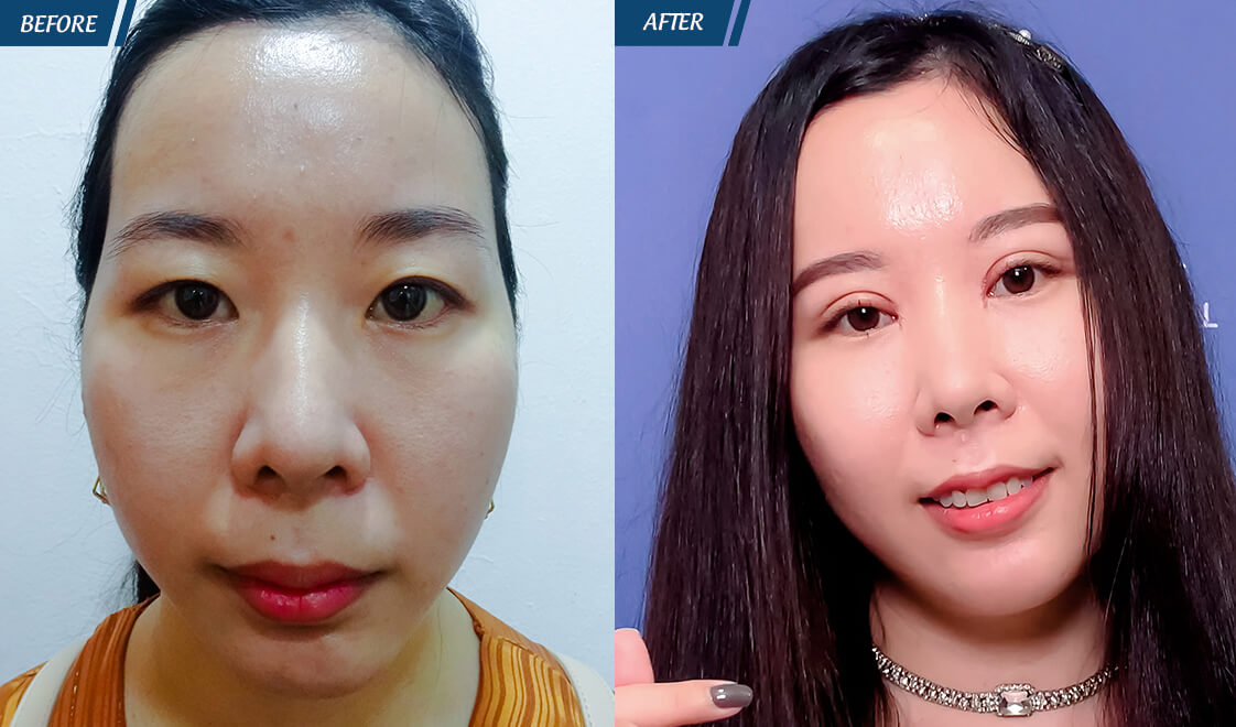 Đặc Quyền Phụ Nữ 08/03