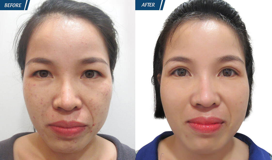 Đặc Quyền Phụ Nữ 08/03