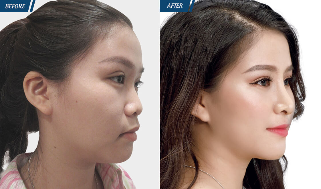 Đặc Quyền Phụ Nữ 08/03