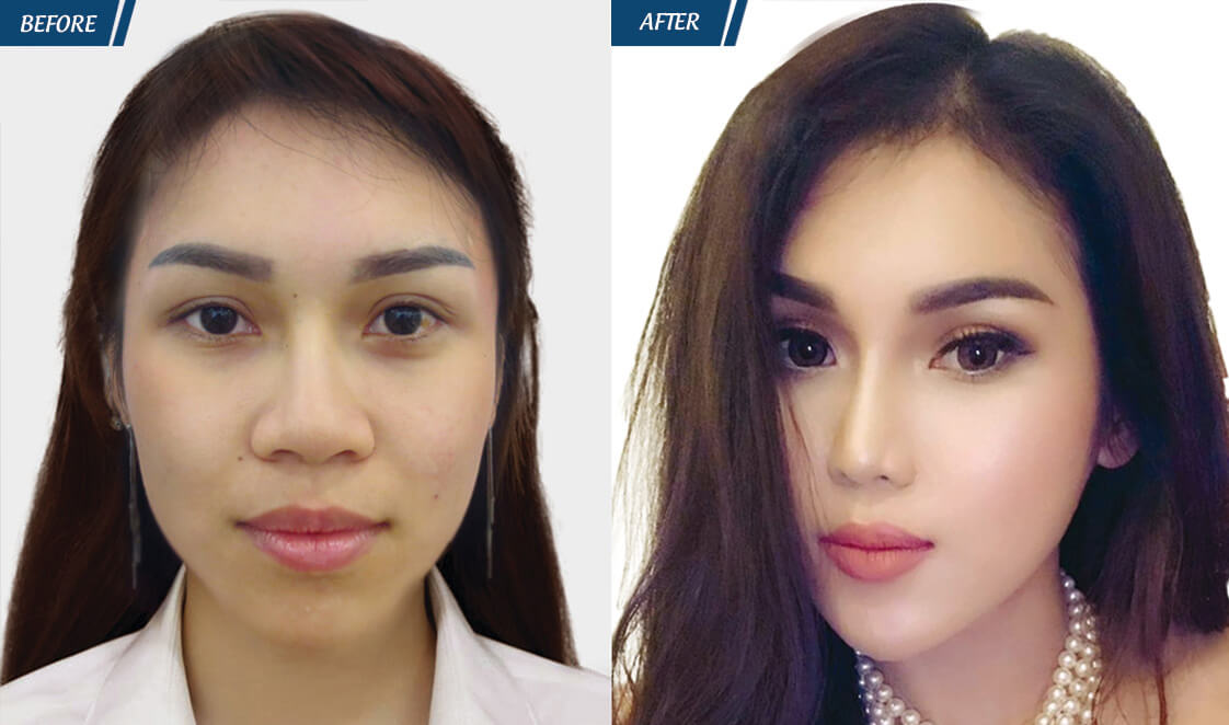 Đặc Quyền Phụ Nữ 08/03