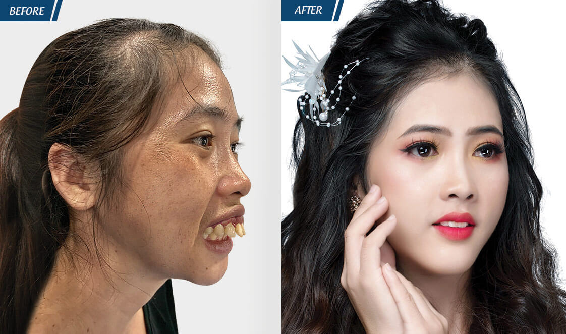 Đặc Quyền Phụ Nữ 08/03