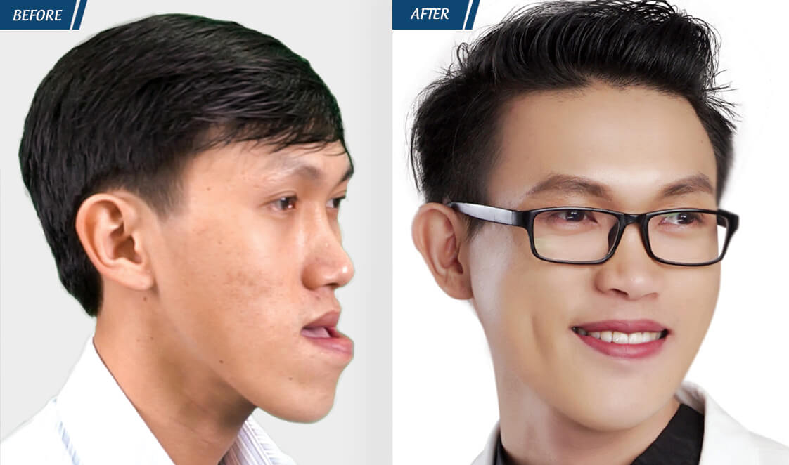 Đặc Quyền Phụ Nữ 08/03