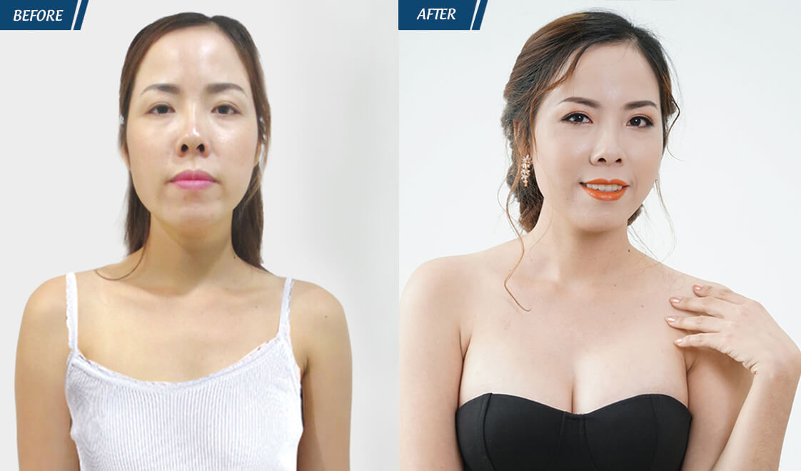 Đặc Quyền Phụ Nữ 08/03