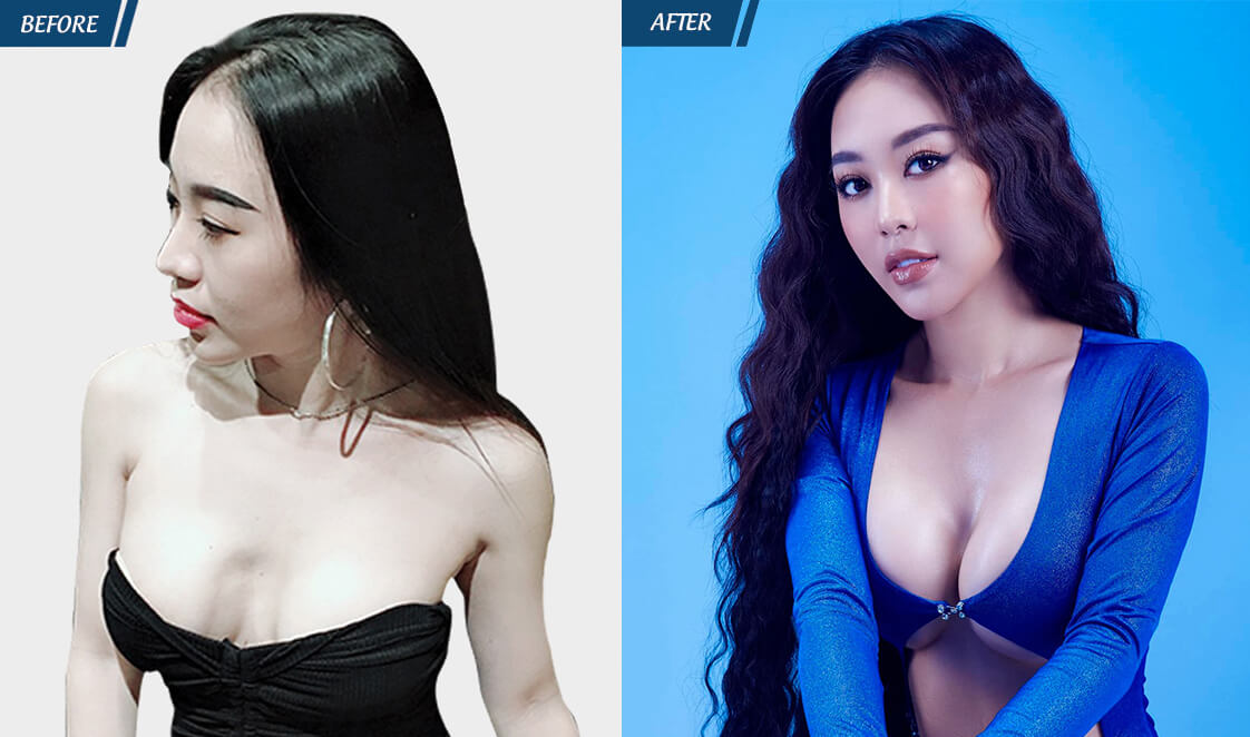 Đặc Quyền Phụ Nữ 08/03