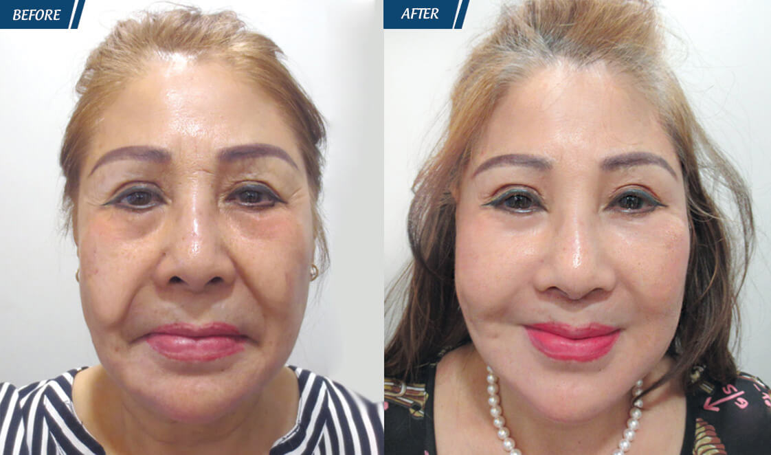 Đặc Quyền Phụ Nữ 08/03