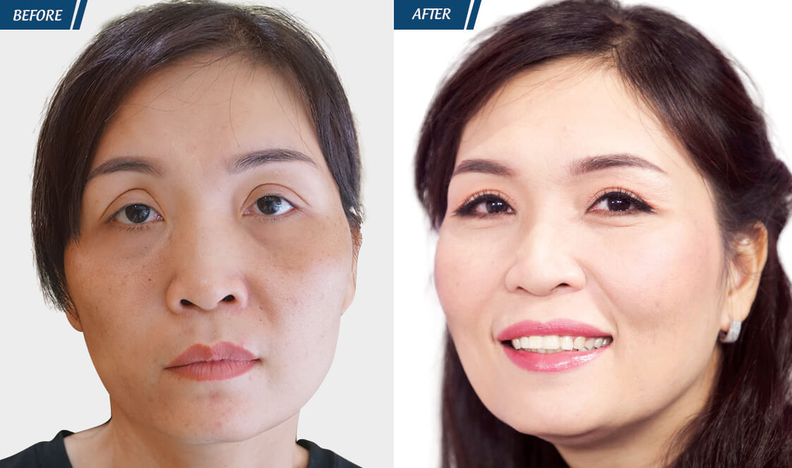 Đặc Quyền Phụ Nữ 08/03