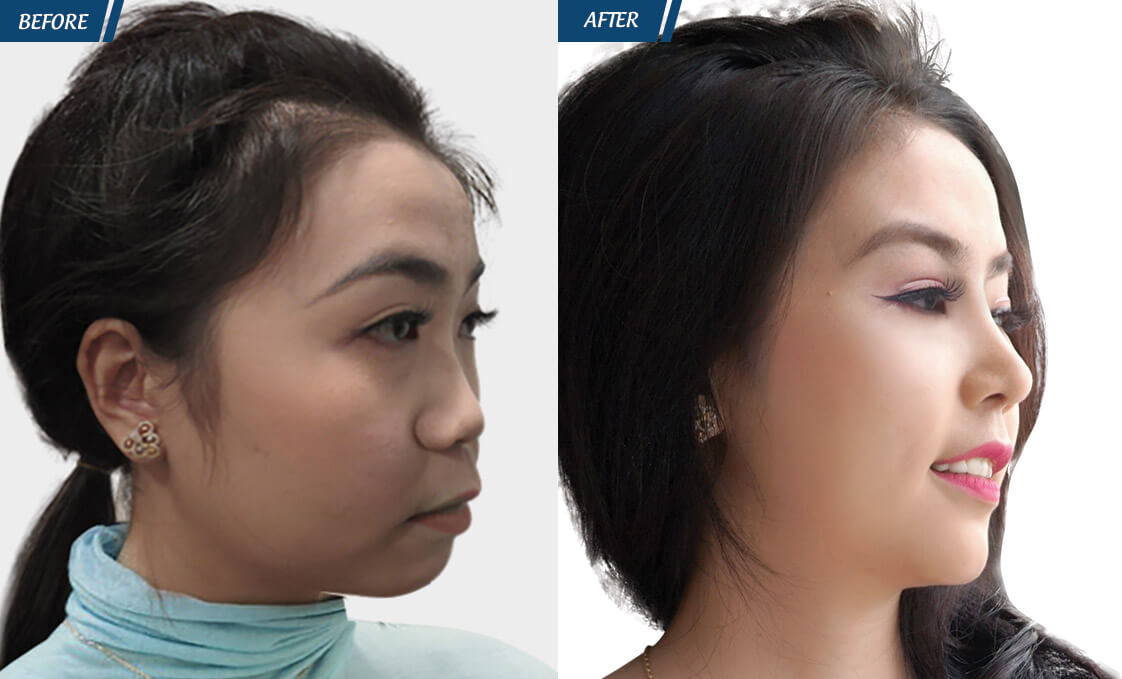 Đặc Quyền Phụ Nữ 08/03