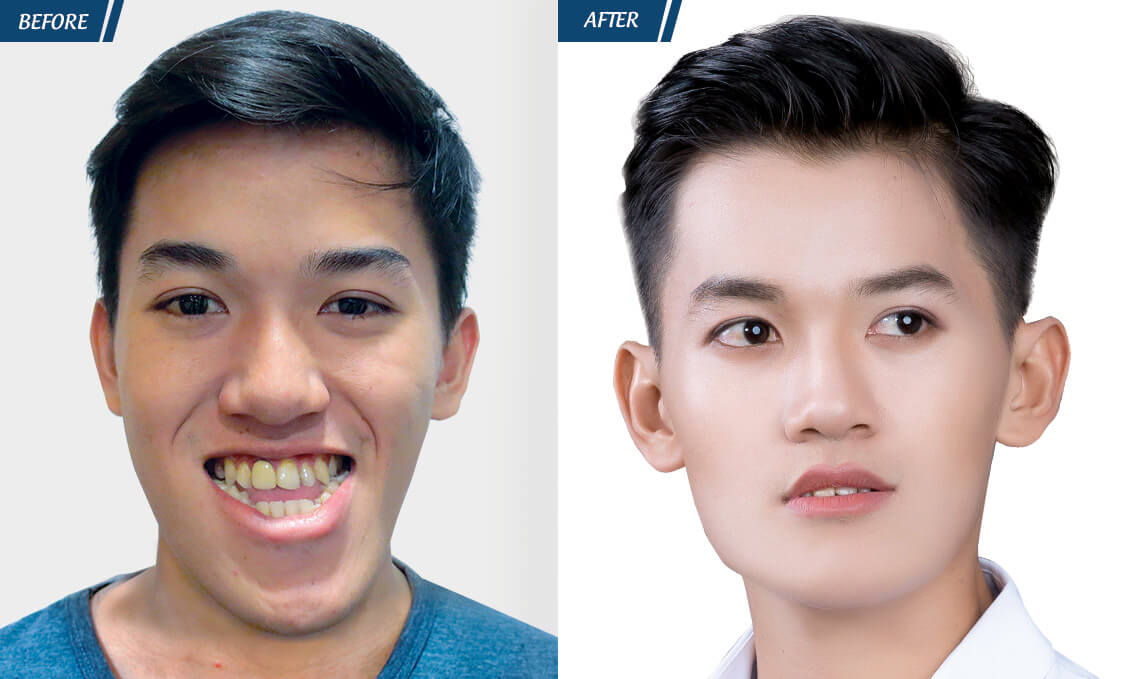 Đặc Quyền Phụ Nữ 08/03