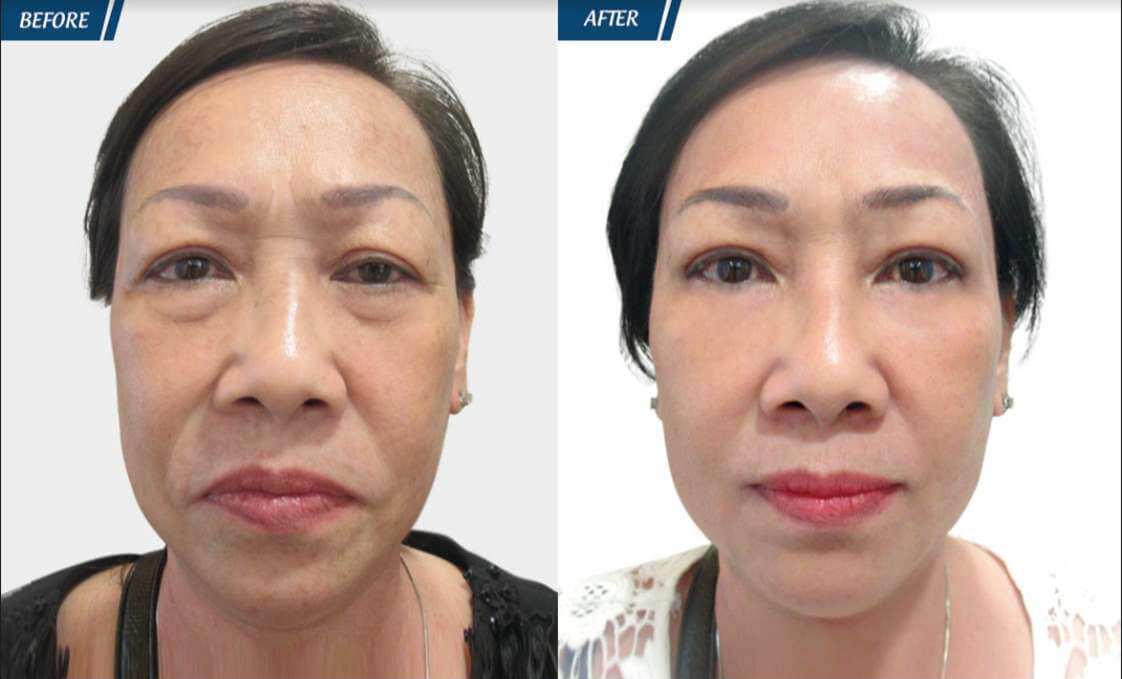 Đặc Quyền Phụ Nữ 08/03