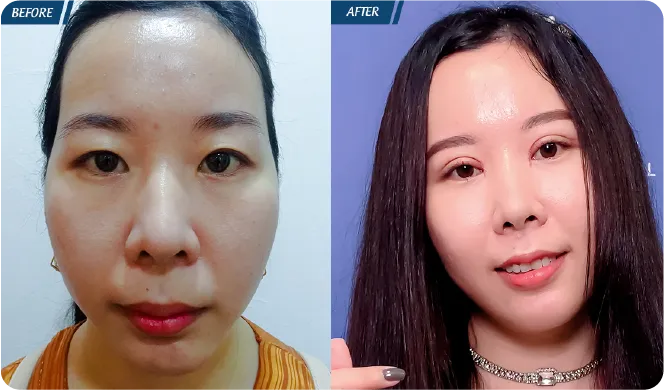 Đại Lễ Thẩm Mỹ