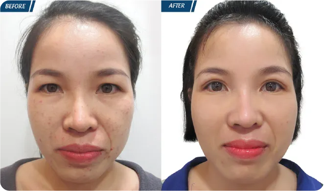 Đại Lễ Thẩm Mỹ