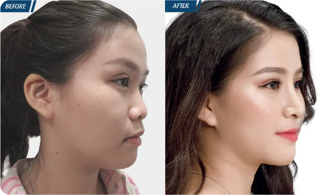 Đại Lễ Thẩm Mỹ