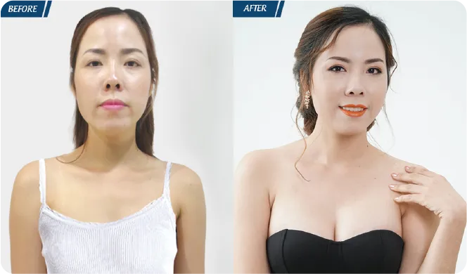 Đại Lễ Thẩm Mỹ