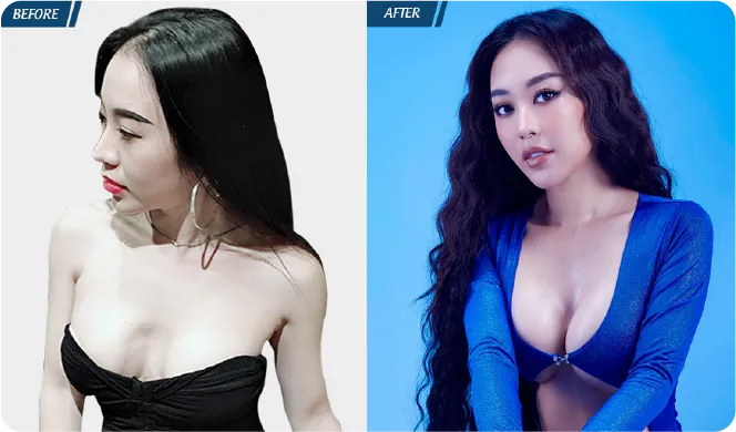 Đại Lễ Thẩm Mỹ