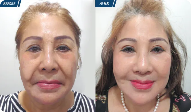 Đại Lễ Thẩm Mỹ