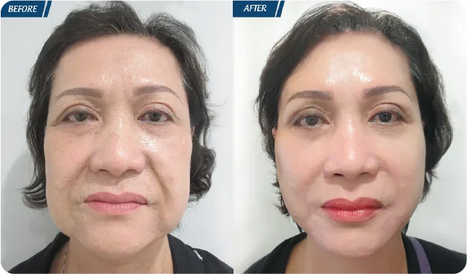 Đại Lễ Thẩm Mỹ