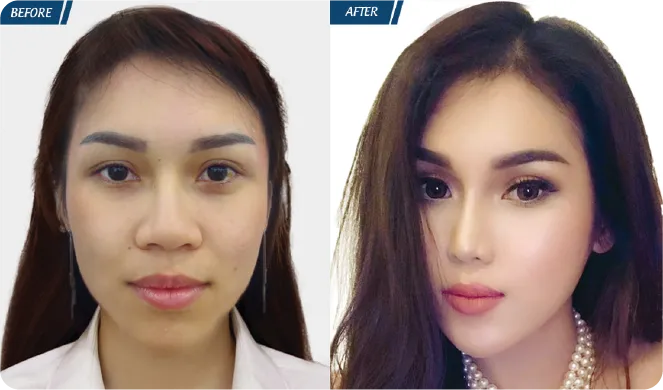 Đại Lễ Thẩm Mỹ