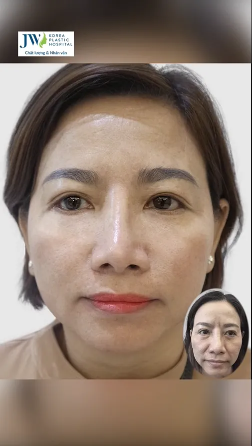 Hội Thảo Da Liễu 2023