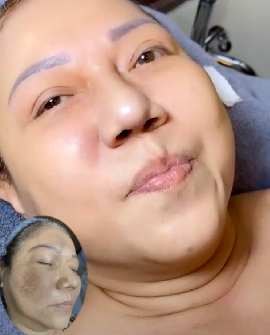 Hội Thảo Da Liễu 2023