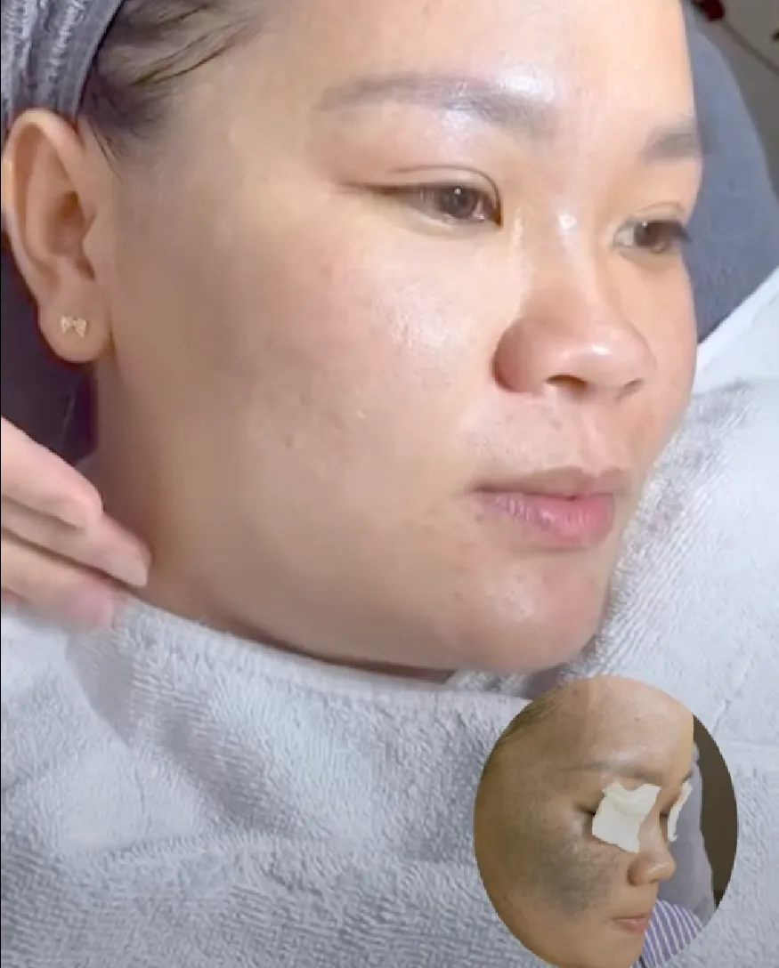 Hội Thảo Da Liễu 2023