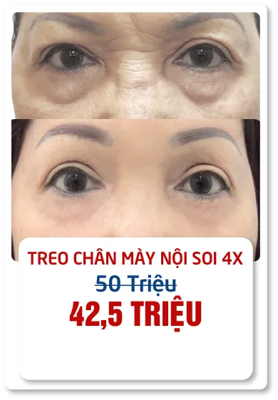 JW 23 NĂM - TIẾP NỐI GIÁ TRỊ THẨM MỸ ĐIỀU TRỊ