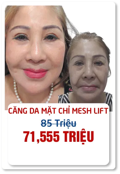 JW 23 NĂM - TIẾP NỐI GIÁ TRỊ THẨM MỸ ĐIỀU TRỊ