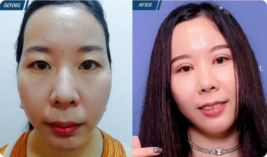 JW 23 NĂM - TIẾP NỐI GIÁ TRỊ THẨM MỸ ĐIỀU TRỊ