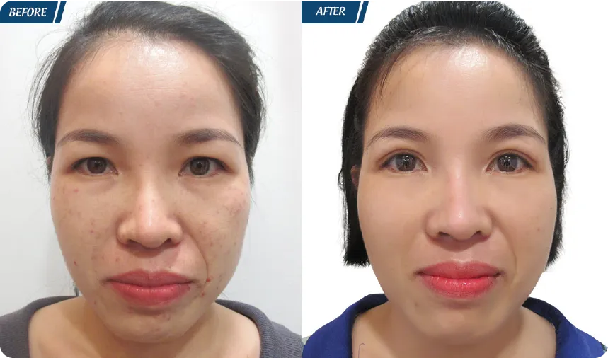 JW 23 NĂM - TIẾP NỐI GIÁ TRỊ THẨM MỸ ĐIỀU TRỊ