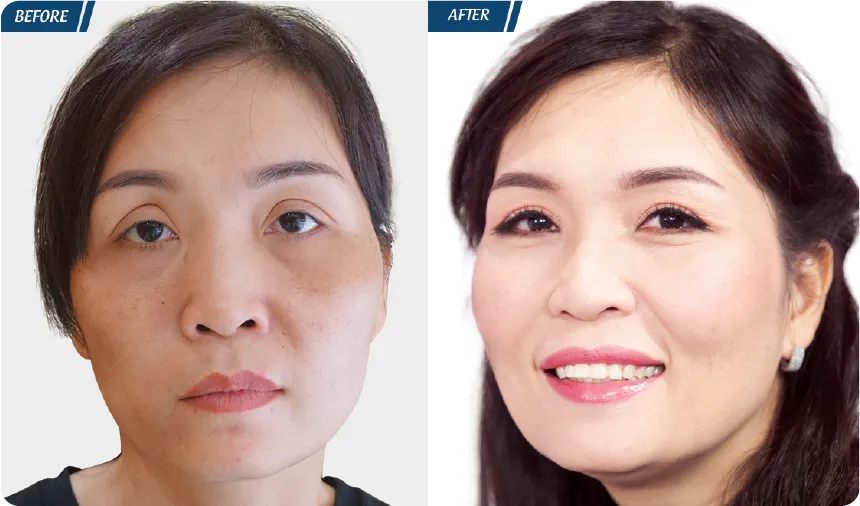 JW 23 NĂM - TIẾP NỐI GIÁ TRỊ THẨM MỸ ĐIỀU TRỊ