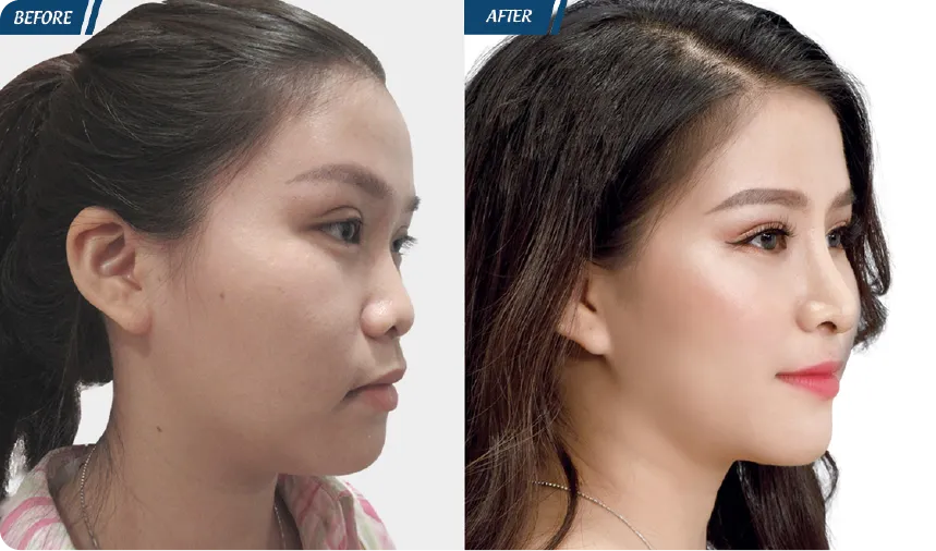 JW 23 NĂM - TIẾP NỐI GIÁ TRỊ THẨM MỸ ĐIỀU TRỊ