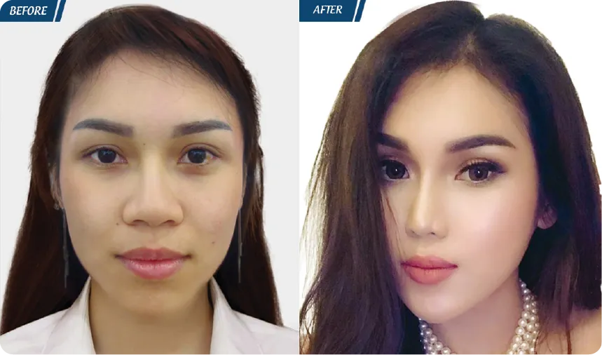 JW 23 NĂM - TIẾP NỐI GIÁ TRỊ THẨM MỸ ĐIỀU TRỊ