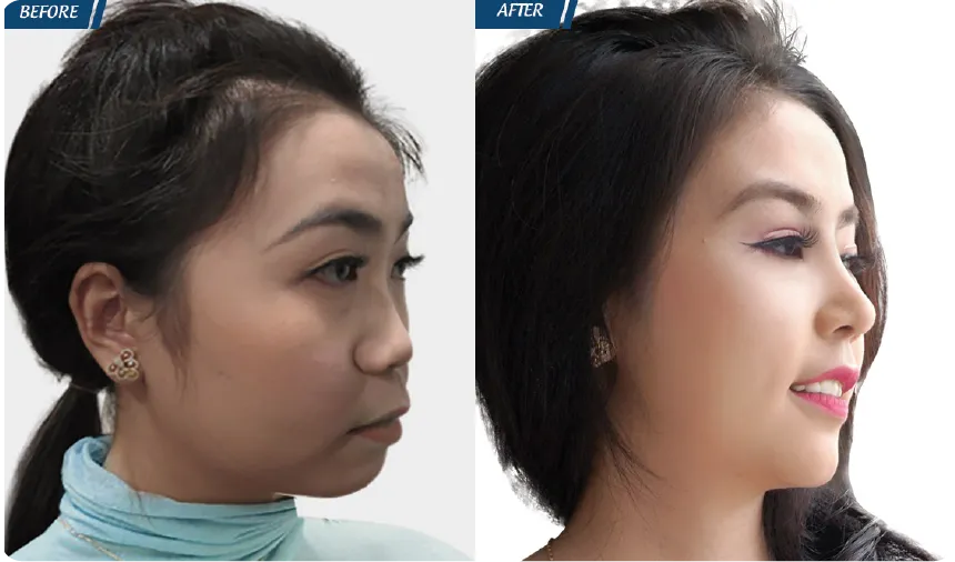 JW 23 NĂM - TIẾP NỐI GIÁ TRỊ THẨM MỸ ĐIỀU TRỊ