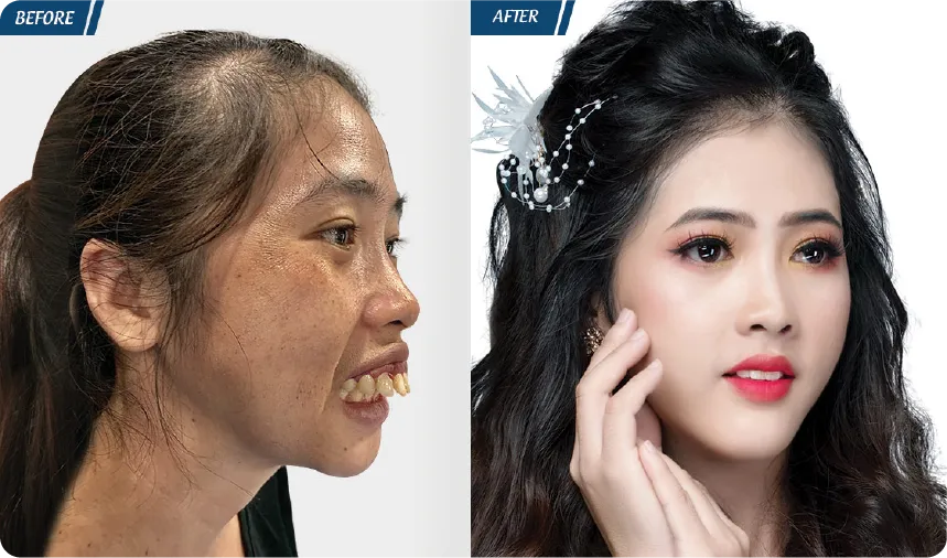 JW 23 NĂM - TIẾP NỐI GIÁ TRỊ THẨM MỸ ĐIỀU TRỊ