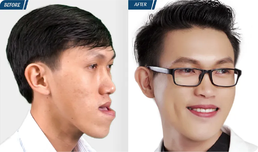 JW 23 NĂM - TIẾP NỐI GIÁ TRỊ THẨM MỸ ĐIỀU TRỊ