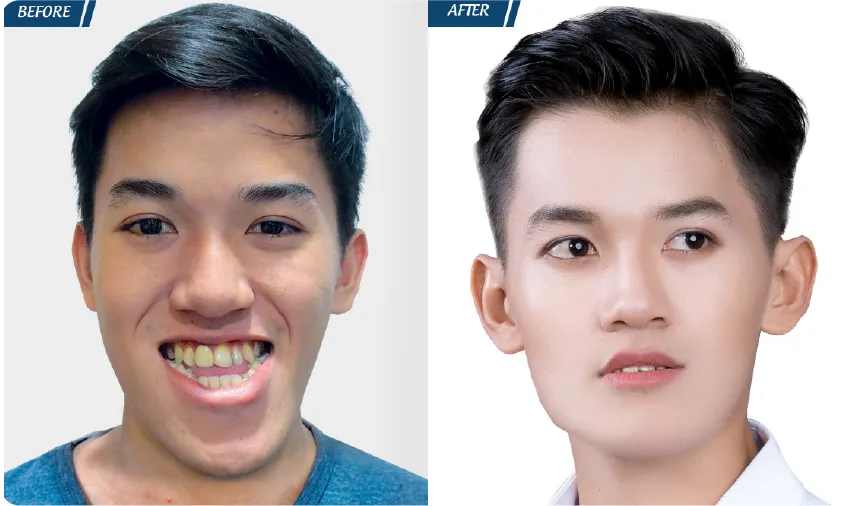 JW 23 NĂM - TIẾP NỐI GIÁ TRỊ THẨM MỸ ĐIỀU TRỊ