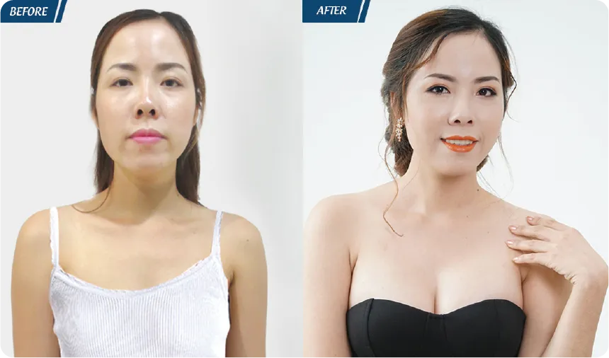 JW 23 NĂM - TIẾP NỐI GIÁ TRỊ THẨM MỸ ĐIỀU TRỊ