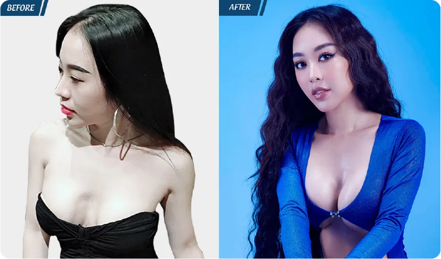 JW 23 NĂM - TIẾP NỐI GIÁ TRỊ THẨM MỸ ĐIỀU TRỊ