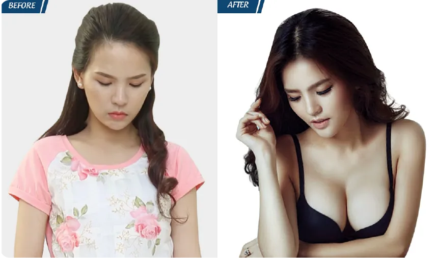 JW 23 NĂM - TIẾP NỐI GIÁ TRỊ THẨM MỸ ĐIỀU TRỊ