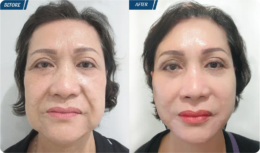 JW 23 NĂM - TIẾP NỐI GIÁ TRỊ THẨM MỸ ĐIỀU TRỊ