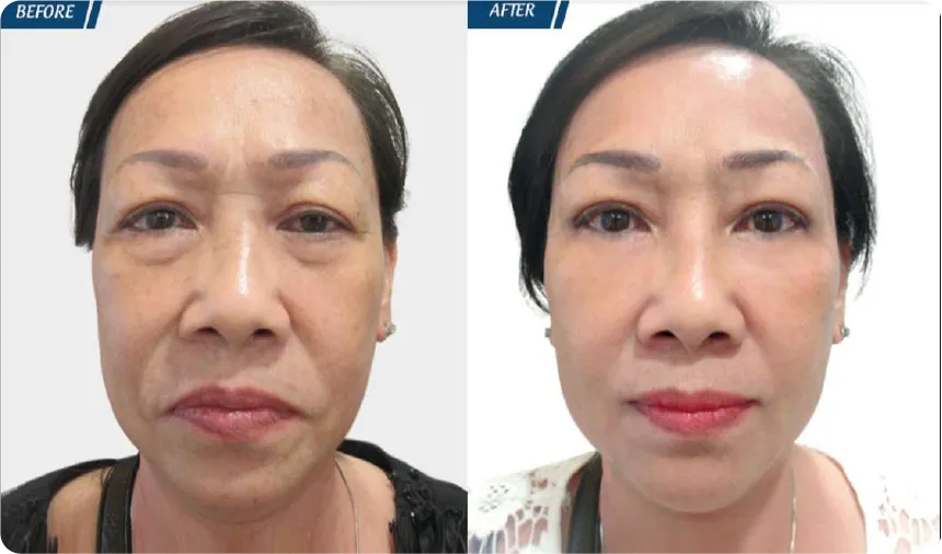 JW 23 NĂM - TIẾP NỐI GIÁ TRỊ THẨM MỸ ĐIỀU TRỊ