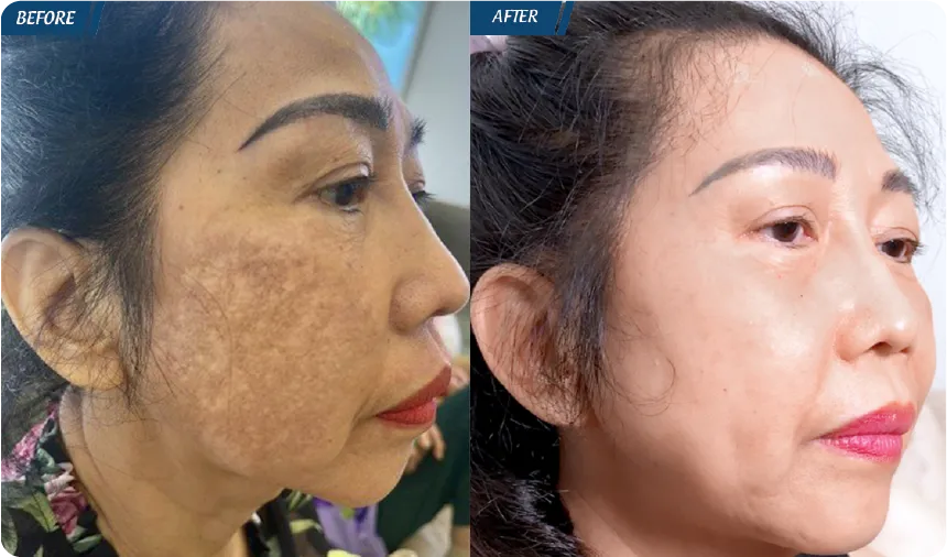 JW 23 NĂM - TIẾP NỐI GIÁ TRỊ THẨM MỸ ĐIỀU TRỊ