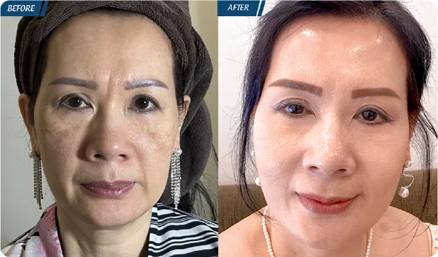 JW 23 NĂM - TIẾP NỐI GIÁ TRỊ THẨM MỸ ĐIỀU TRỊ