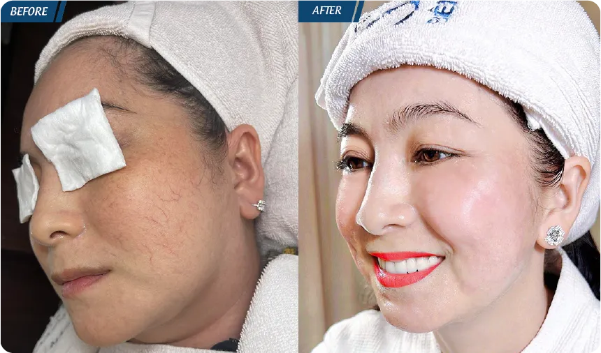 JW 23 NĂM - TIẾP NỐI GIÁ TRỊ THẨM MỸ ĐIỀU TRỊ