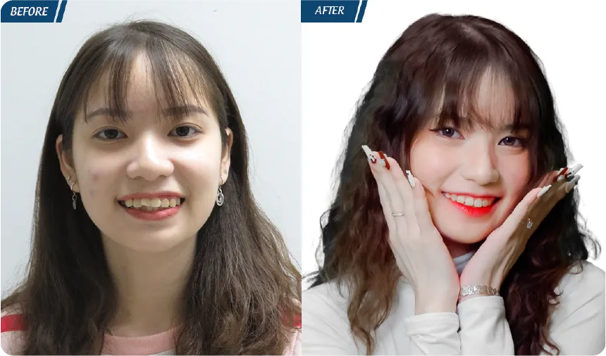 JW 23 NĂM - TIẾP NỐI GIÁ TRỊ THẨM MỸ ĐIỀU TRỊ