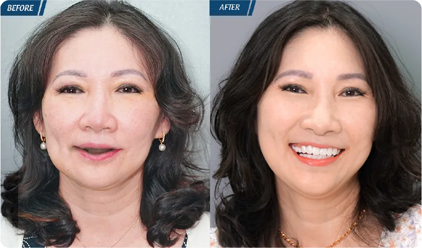 JW 23 NĂM - TIẾP NỐI GIÁ TRỊ THẨM MỸ ĐIỀU TRỊ