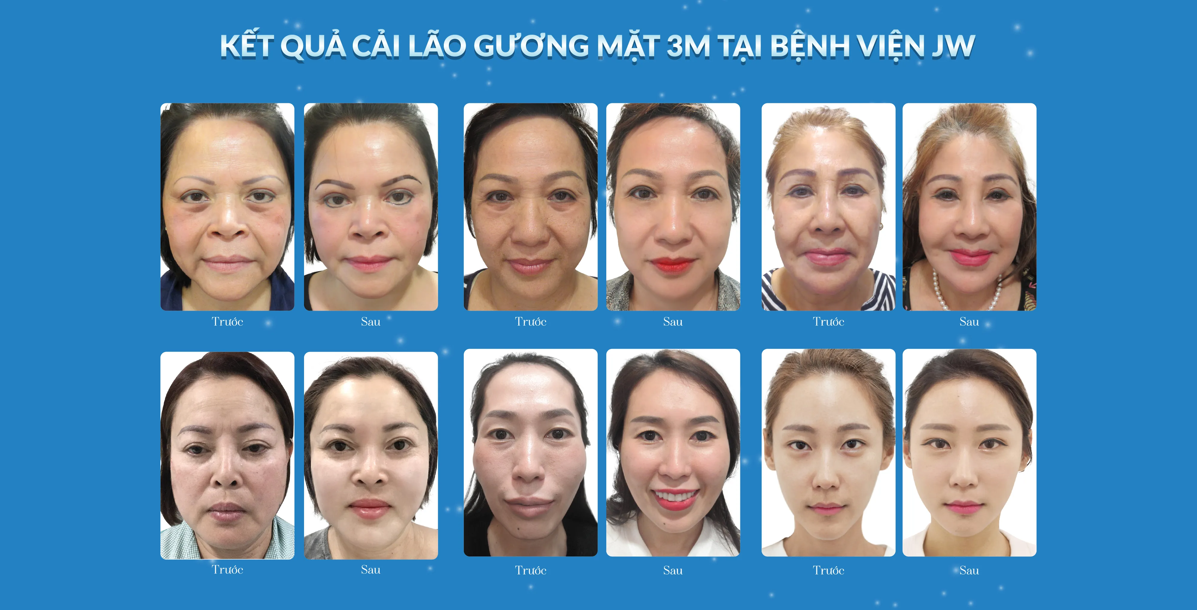 Cải Lão Gương Mặt 3M